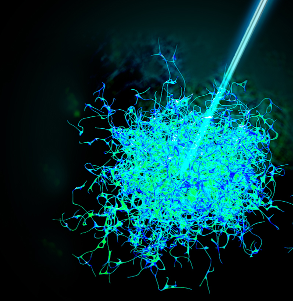 今天,我們把腫瘤的內部「融穿」了